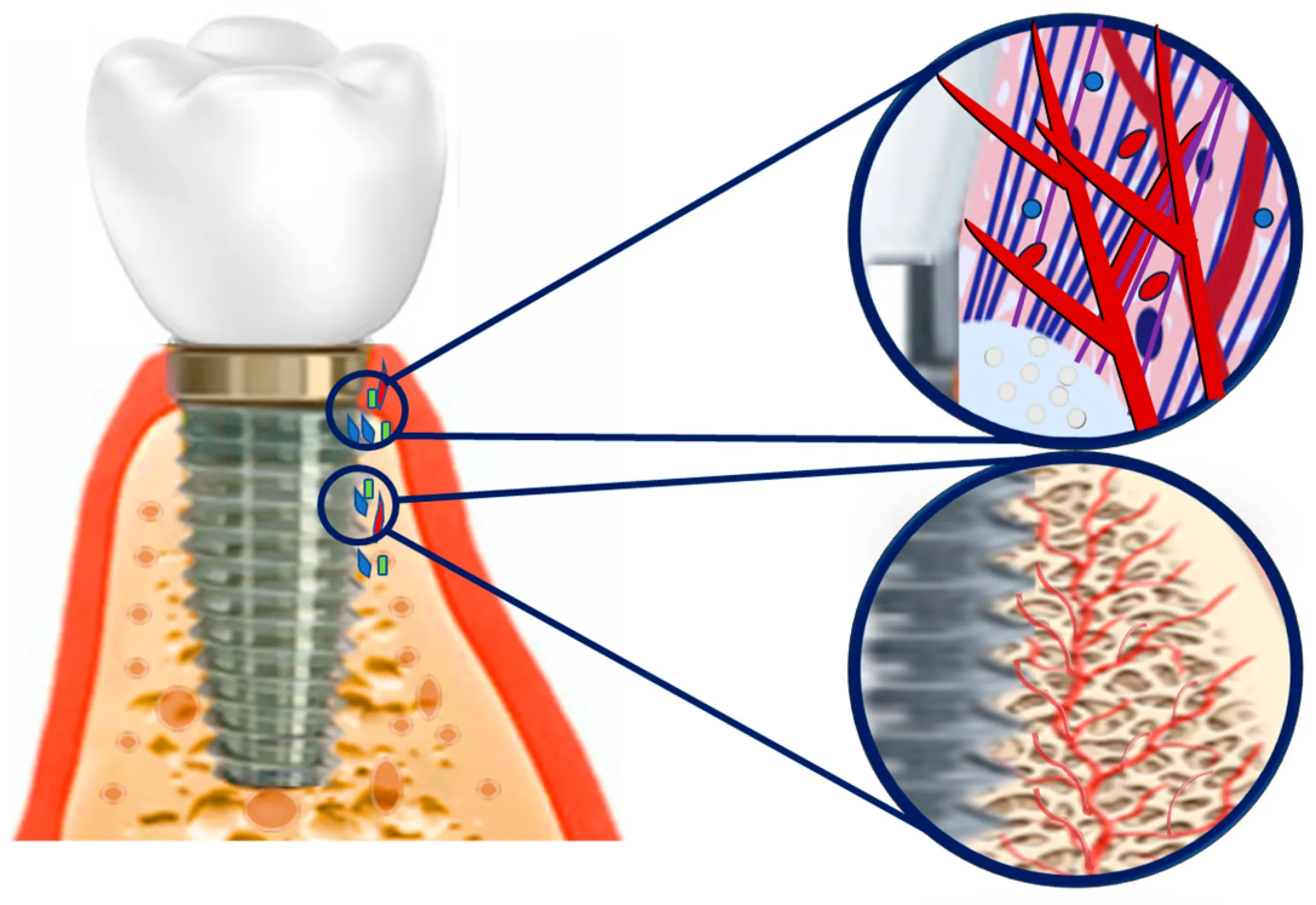 Medical Grade Stainless Steel